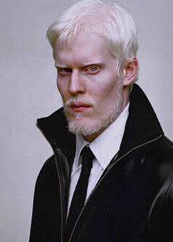 Albino model poses in Givenchy's Spring ad campaign 